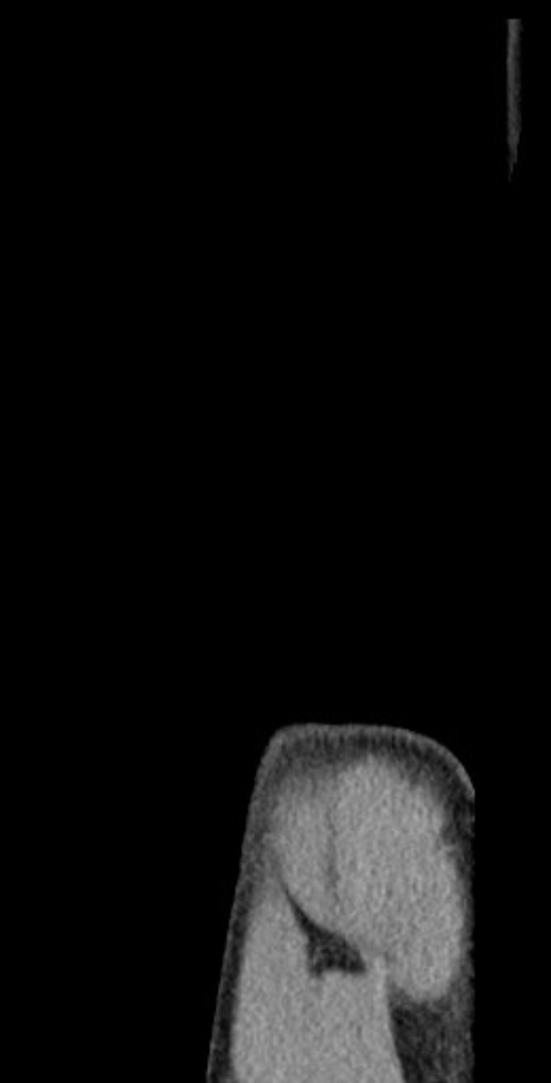 Schwarze und weiße MRI-Aufnahme eines Knies, die detaillierte anatomische Strukturen zeigt.